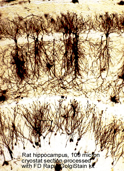 Rapid Golgi Stain Kit for Fast Neuronal Analysis - FD Neuro